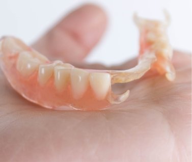 Partial denture resting in an open palm