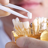 Asheville implant dentist holding restoration and model of dental implants