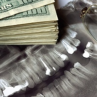 X-ray and money symbolizing the cost of dental implants in Asheville 