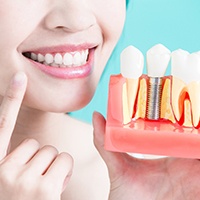 Dentist pointing to her smile holding model of dental implants in Asheville