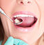 Thumbnail of woman having dental exam