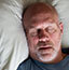 Man sleeping peacfully after receiving sleep apnea treatment 