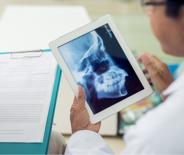 Checking x ray of jaw on tablet