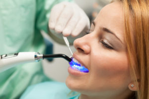 Your dentist in Asheville hopes to catch any dental issues early on with excellent advanced preventive care. 