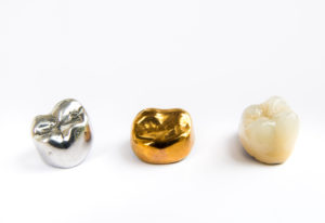 several dental crowns covered by dental insurance
