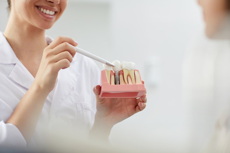 mouth mold with single dental implant