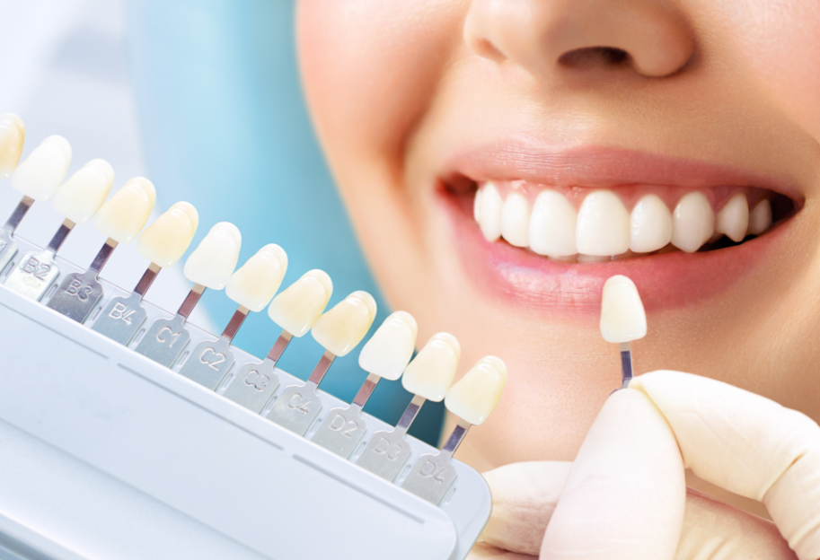 Dentist holding up veneers to patient's smile
